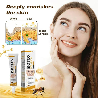 Botox Bee Venom Wrinkle Removal Cream Get Free Home Delivery