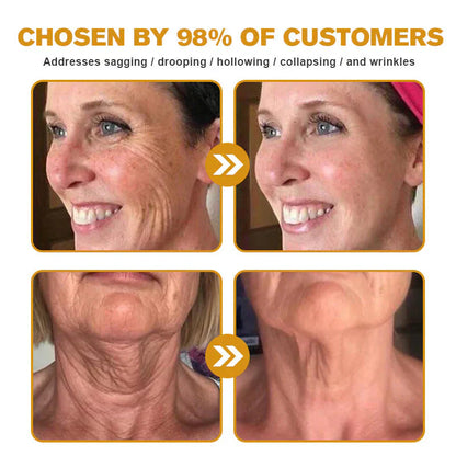 Botox Bee Venom Wrinkle Removal Cream Get Free Home Delivery