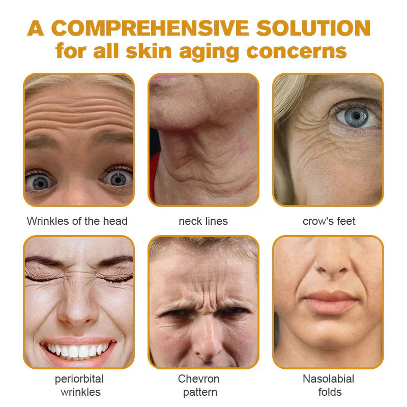 Botox Bee Venom Wrinkle Removal Cream Get Free Home Delivery